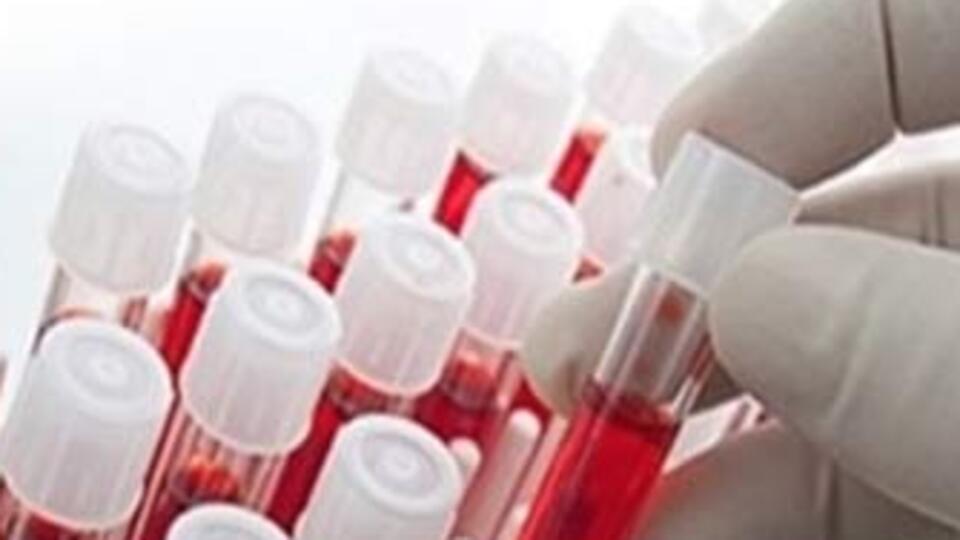 Hangi kan grubunun IQ'su daha yüksek?