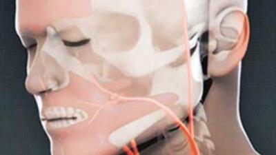 Yüz naklinin bilinmeyen yüzü