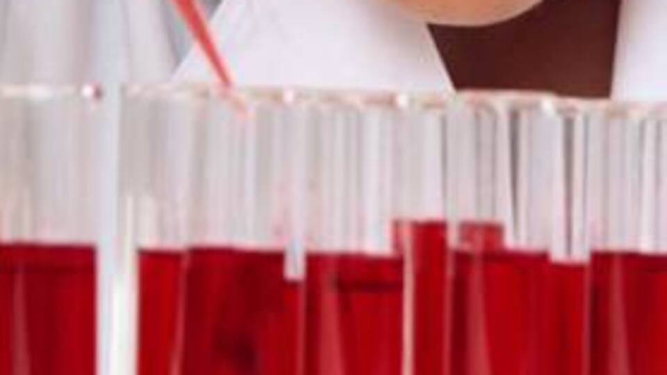 HIV, anında tespit edilebilir mi?
