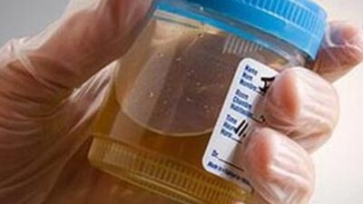 İdrar yolu mucizesi!