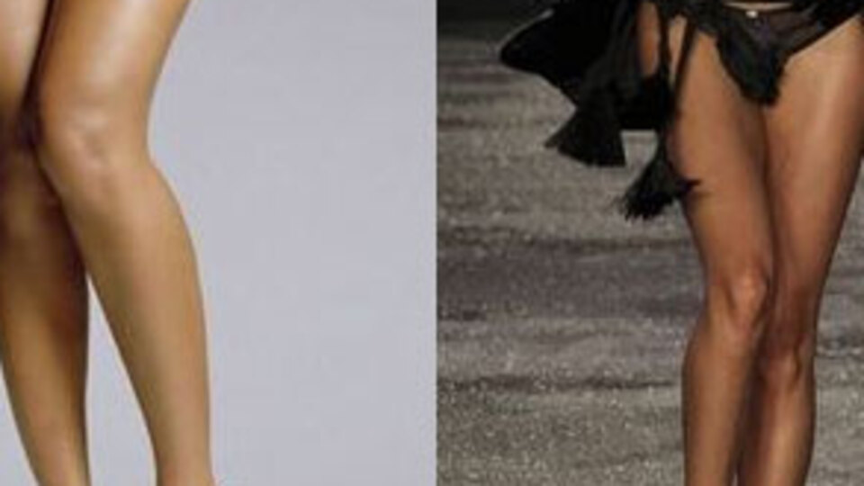 Fıstık gibi bacaklar! GALERİ