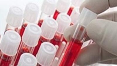 Böylesi görülmedi!