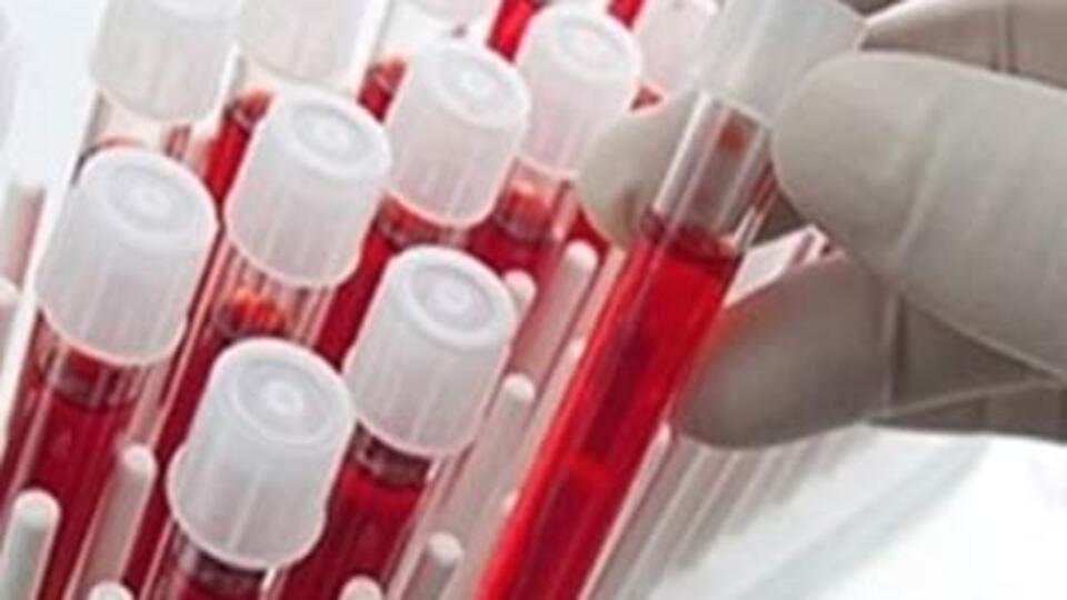 Böylesi görülmedi!