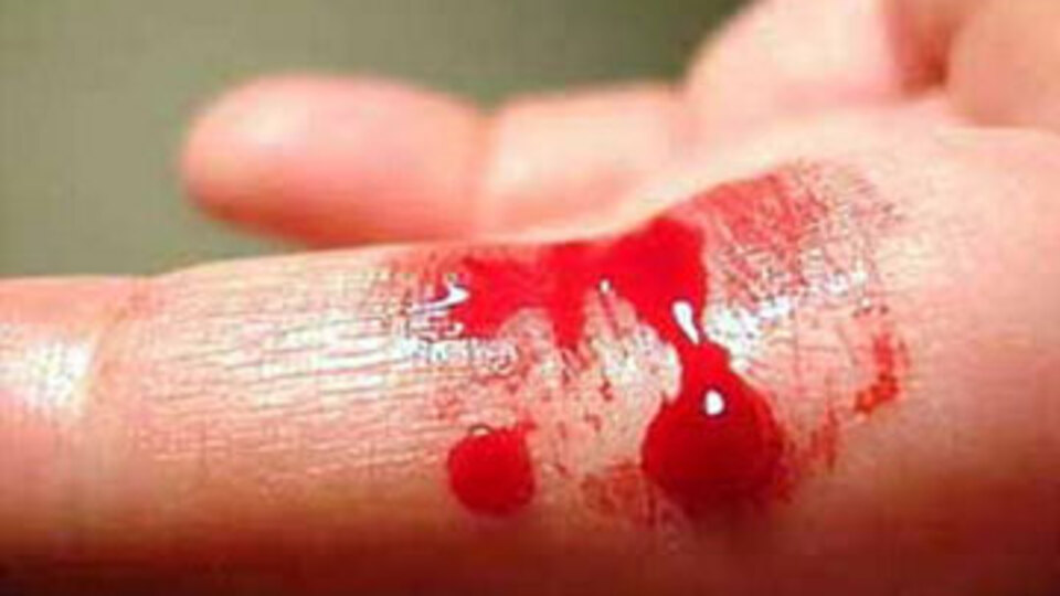 Bugün "Dünya Hemofili Günü"