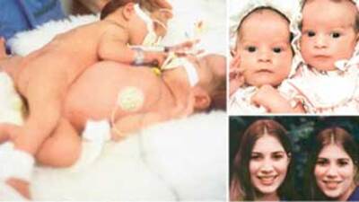 28 yıl önce Türk doktorun başlattığı mucize!