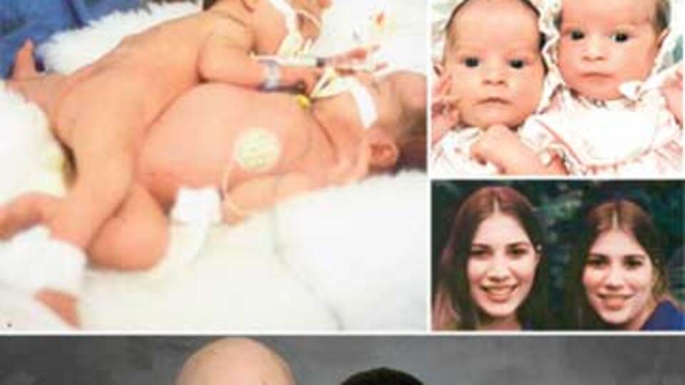 28 yıl önce Türk doktorun başlattığı mucize!