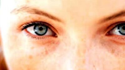 Hayatın kaynağı cildimizin düşmanı