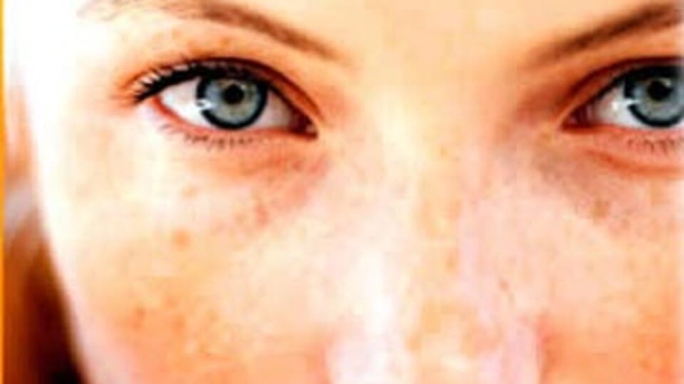 Hayatın kaynağı cildimizin düşmanı