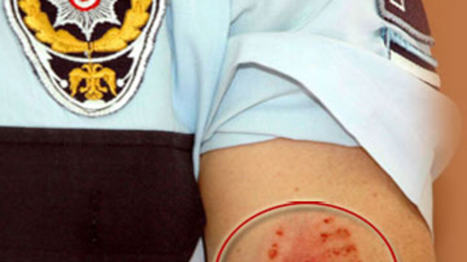 Çevirme yapan polisleri ısırdı!