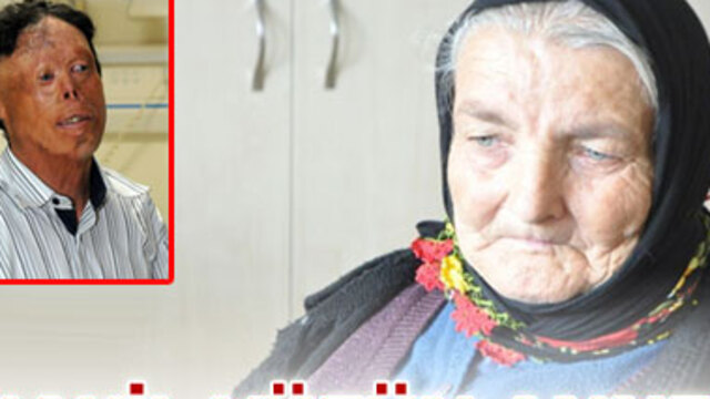 "Nakil yüz"ün annesini Bakan nakletti!