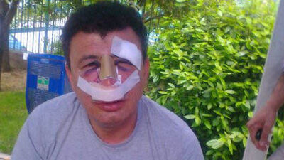 Beden öğretmenine muştalı dayak! GALERİ