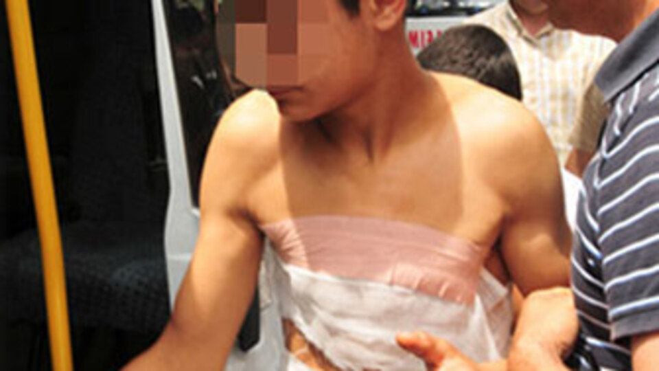 Molotof atan çocuğa 39 yıl hapis istemi