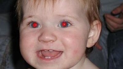 Kırmızı göz sağlık habercisi!