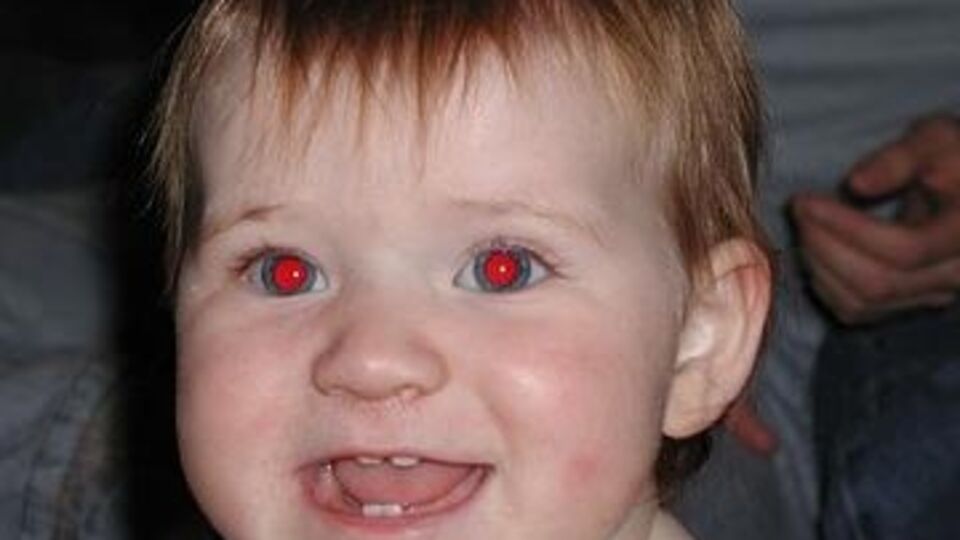 Kırmızı göz sağlık habercisi!