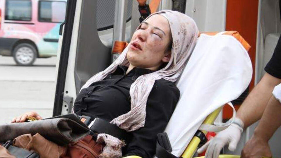 Erkek arkadaştan bayıltan dayak!