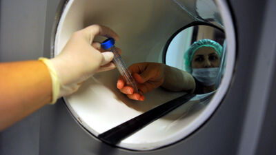 Testissiz baba oldu!