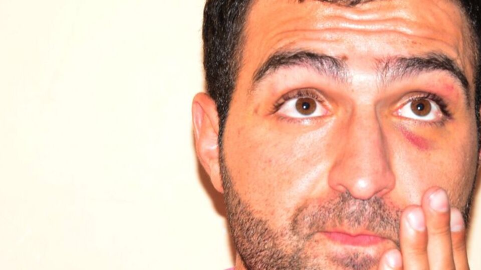 Polis dayağında flaş gelişme!