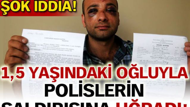1,5 yaşındaki oğluyla saldırıya uğradı!
