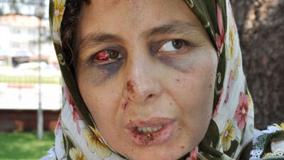 Bakanlık kadın davalarına müdahil oluyor