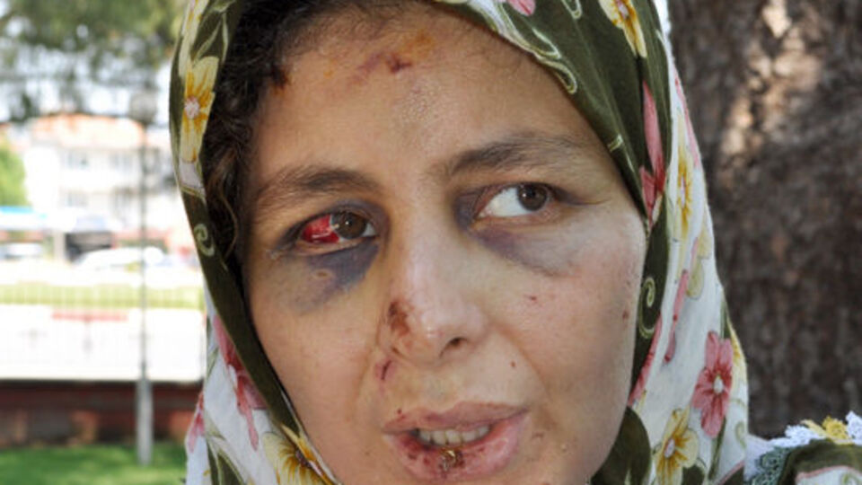 Bakanlık kadın davalarına müdahil oluyor