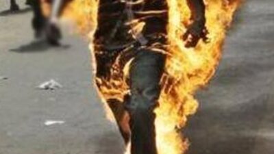 Kızını protesto etmek için kendini yaktı!