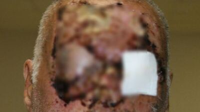 Yamyam dehşetini anlattı