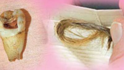 Napolyon'un penisine 100 bin dolar!