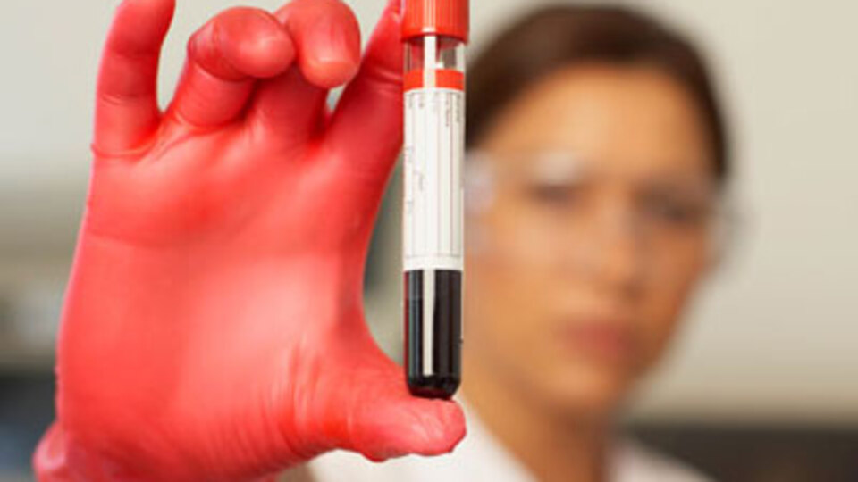 İlaç yerine kendi kanınızı kullanın!