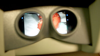 Türk göz cerrahisinde 'devrim'