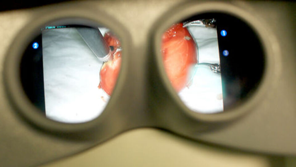 Türk göz cerrahisinde 'devrim'