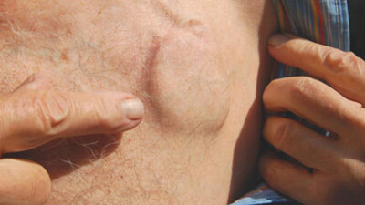 Kalp pilinde devrim!