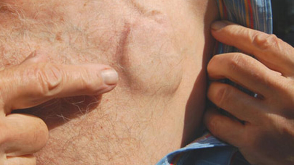 Kalp pilinde devrim!