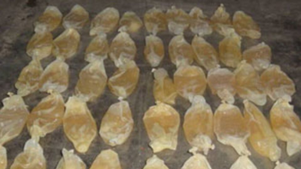 48 prezervatif yuttu!