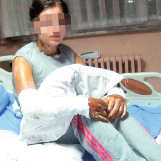 Üniversiteliye 'Taliban' usulü asitli saldırı