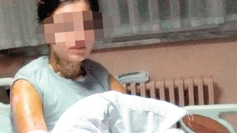 Üniversiteliye 'Taliban' usulü asitli saldırı