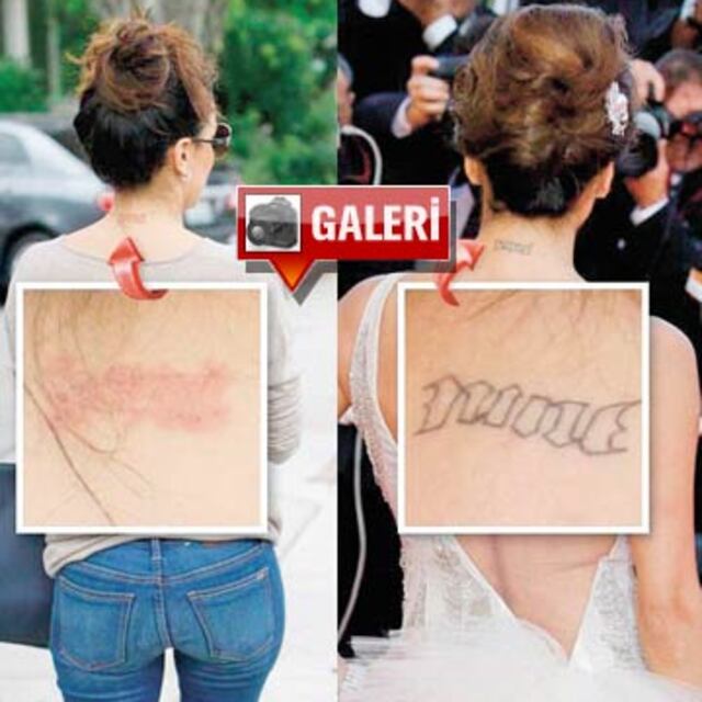 Dövmelerini sildiriyor