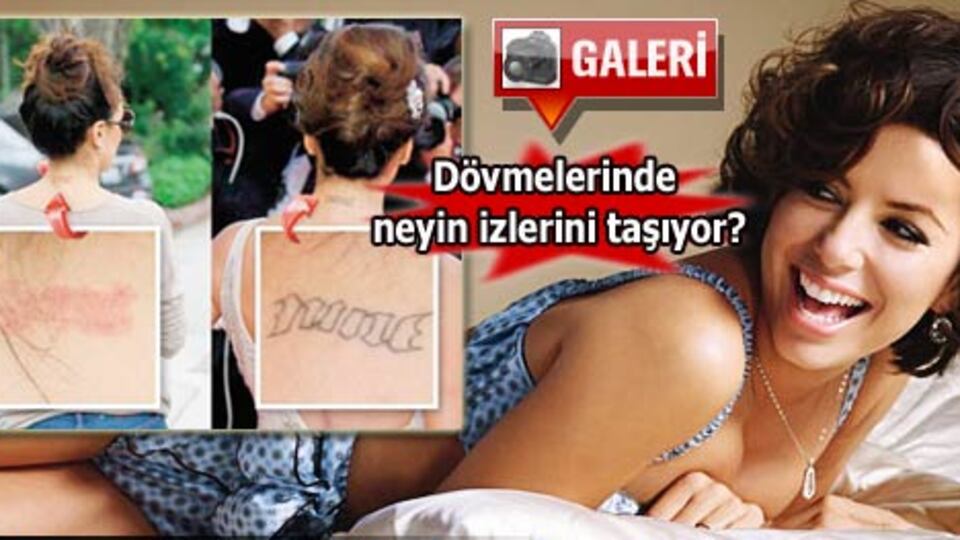 Dövmelerini sildiriyor