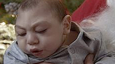 3 yıl beyinsiz yaşadı