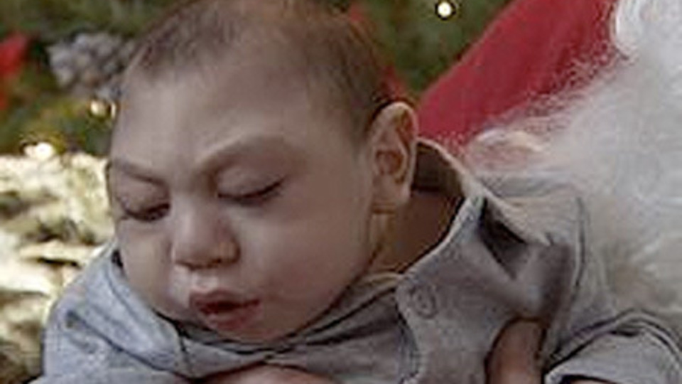 3 yıl beyinsiz yaşadı