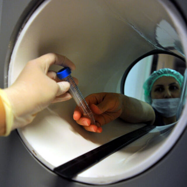 Erkekler kısırlığa veda mı ediyor?