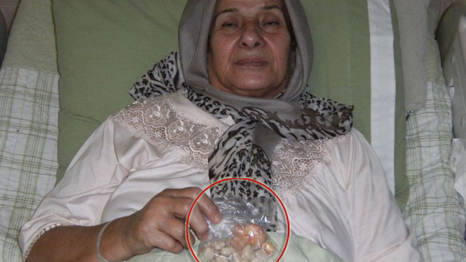 Dizlerinden taş çıktı!