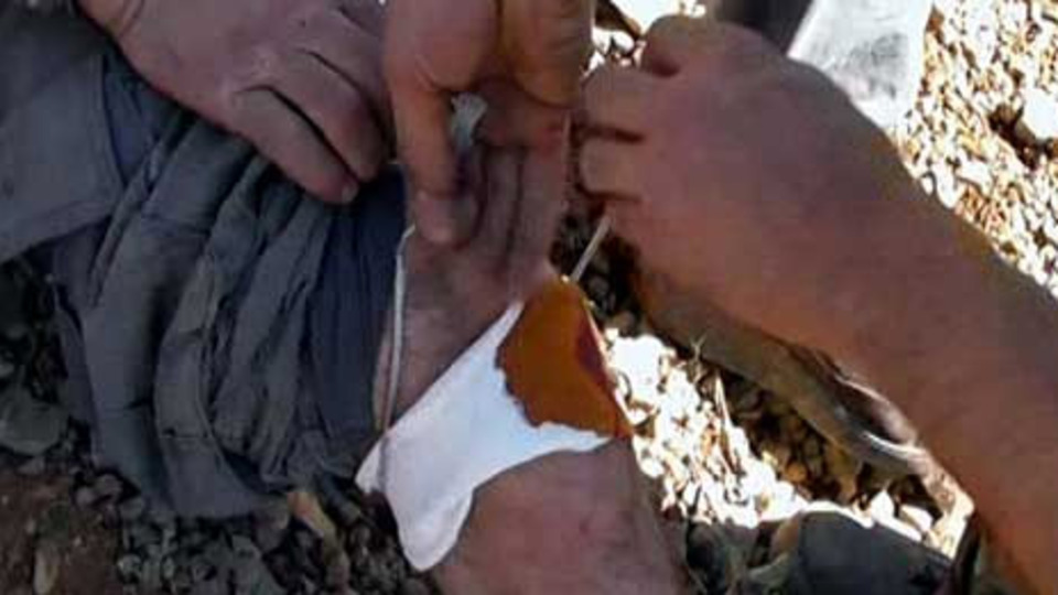 Mehmetçik'le teröristin karşılaştığı o an!