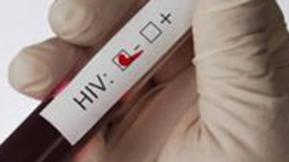 Farketmeden AIDS olabilirsiniz!