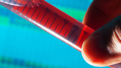 AIDS en çok kimlerde görülüyor?