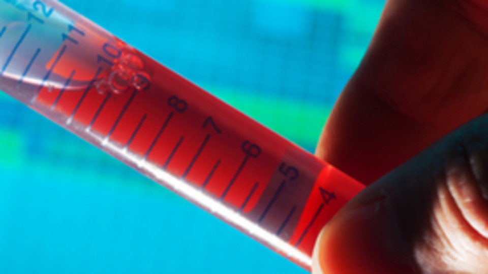 AIDS en çok kimlerde görülüyor?