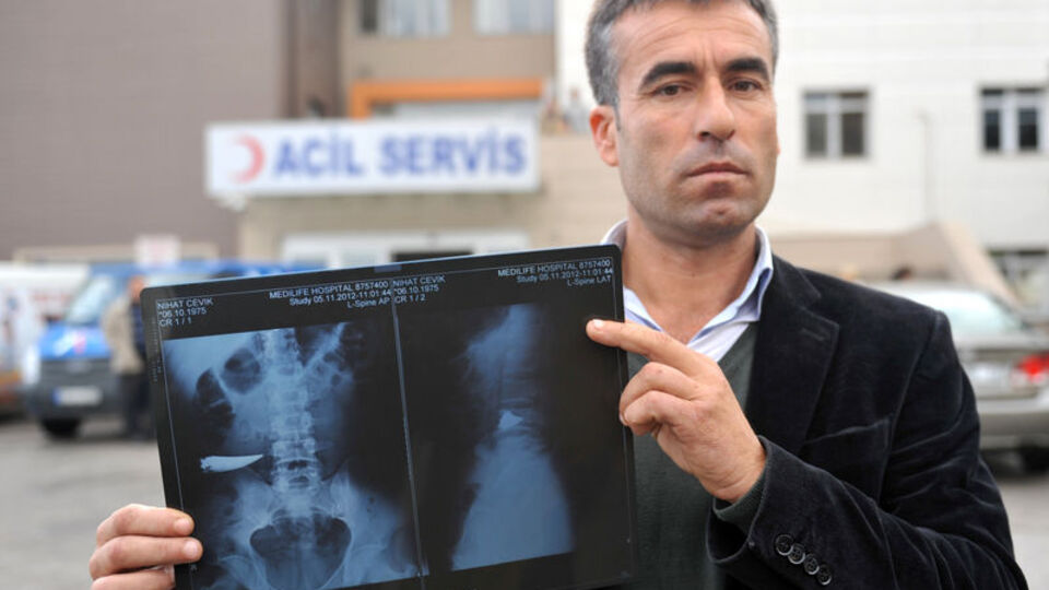 9 yıl, içinde bununla yaşamış!