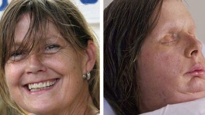 Şempanze saldırdı, 4 milyon dolar kazandı