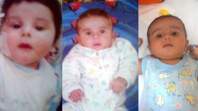 O hastalık 3 kardeşin kabusu oldu