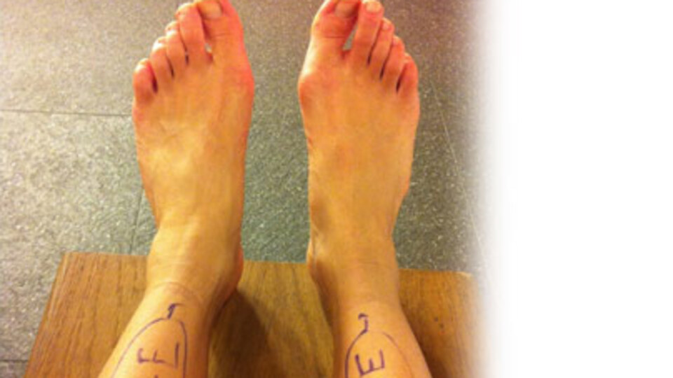 Başparmağınıza iyi bakın!