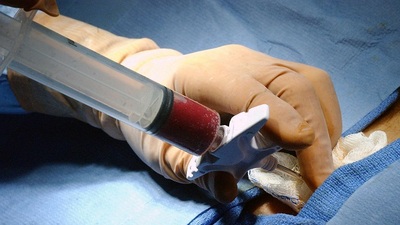 Akraba dışı ilik nakli yapılacak!